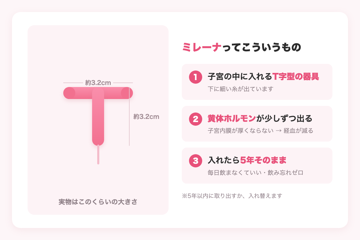 ミレーナの図解。子宮の中に入れる約3.2cmのT字型の器具で、黄体ホルモンが少しずつ出て、入れたら5年そのまま